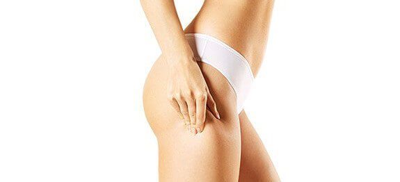 Soignerla cellulite