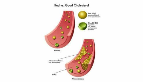 Baisser le taux de cholestérol
