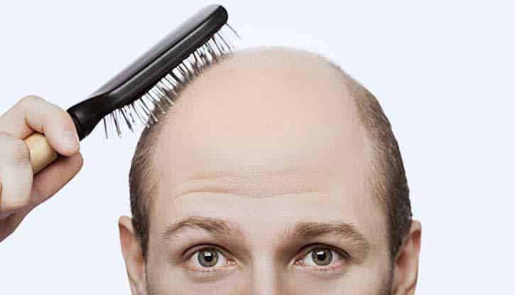 Traitement naturels contre la chute de cheveux