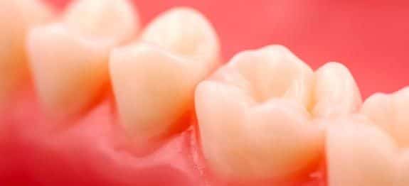 Comment soigner une gingivite naturellement ?