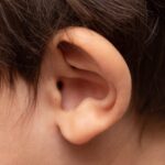 Harmonie sonore : explorer des remèdes naturels pour soigner les pertes d'audition