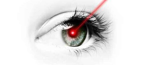 Chirurgie laser des yeux