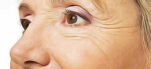 Atténuer naturellement les rides au bord des yeux