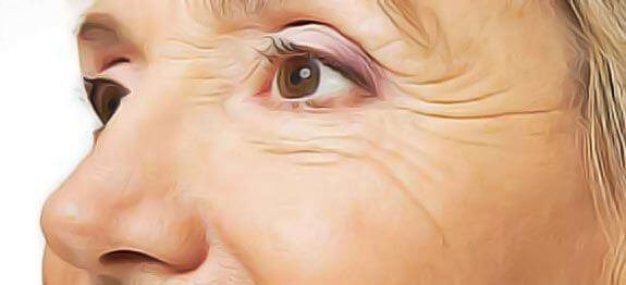 Atténuer naturellement les rides au bord des yeux