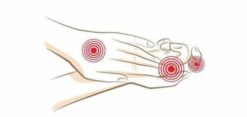 remèdes contre les mains sèches