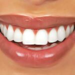8 Solutions Simples pour Améliorer sa Santé Bucco-dentaire