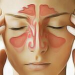 Sinus Douloureux : Comment Se Soigner Soi-Même