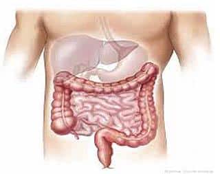 cura dell'intestino irritato del colon