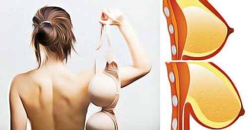 soutien gorge et sante