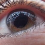 Vous allez être surpris par l’efficacité de ces astuces naturelles contre les orgelets