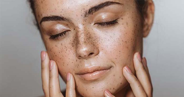 Hoe een gemengde huid behandelen, welke verzorging kunnen we eraan geven?