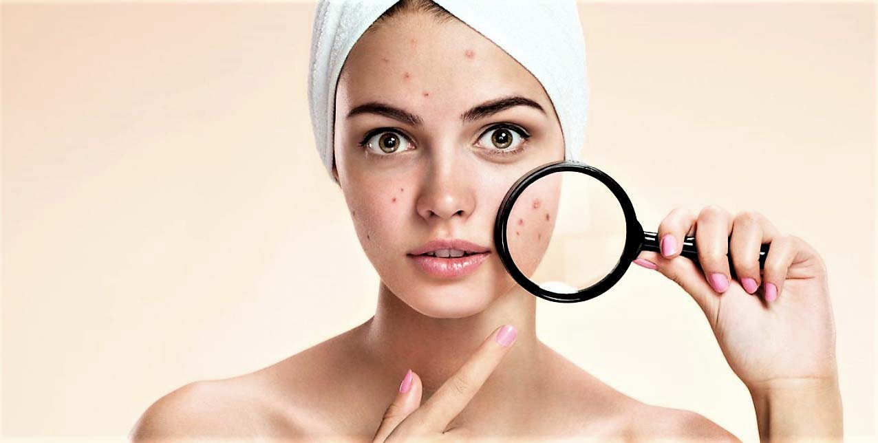 migliori punti di digitopressione per l'acne del viso