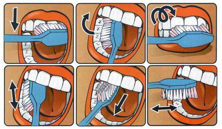 fai un ridimensionamento dei denti a casa