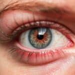 Compresses de camomille : le secret pour apaiser les yeux irrités par les allergies !