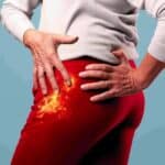Douleurs à la hanche : 11 causes possibles et leurs solutions